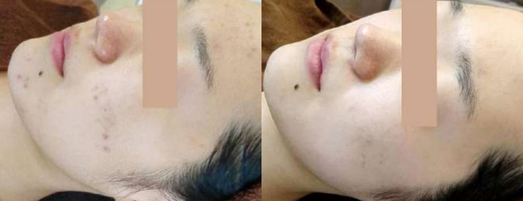 業務用美容機｜株式会社 エステツイン