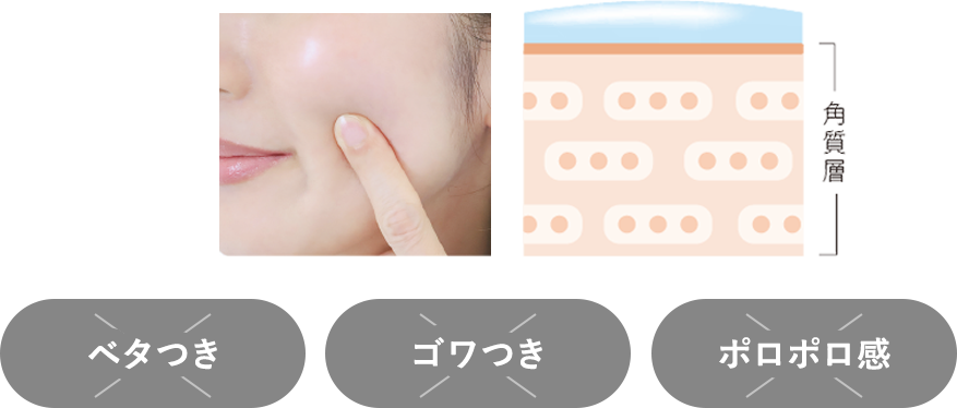 エステツイン SEシリーズ｜株式会社 エステツイン